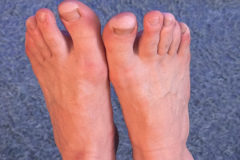 One for the feet lovers - Little bit of damp toe